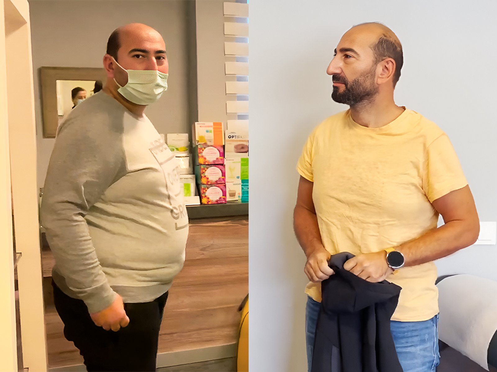 Sadece Ameliyat Yapmıyoruz: Obezite Tedavisinde Bütünsel Yaklaşım